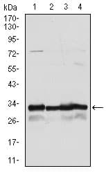 NQO1 Antibody (clone 1A11)