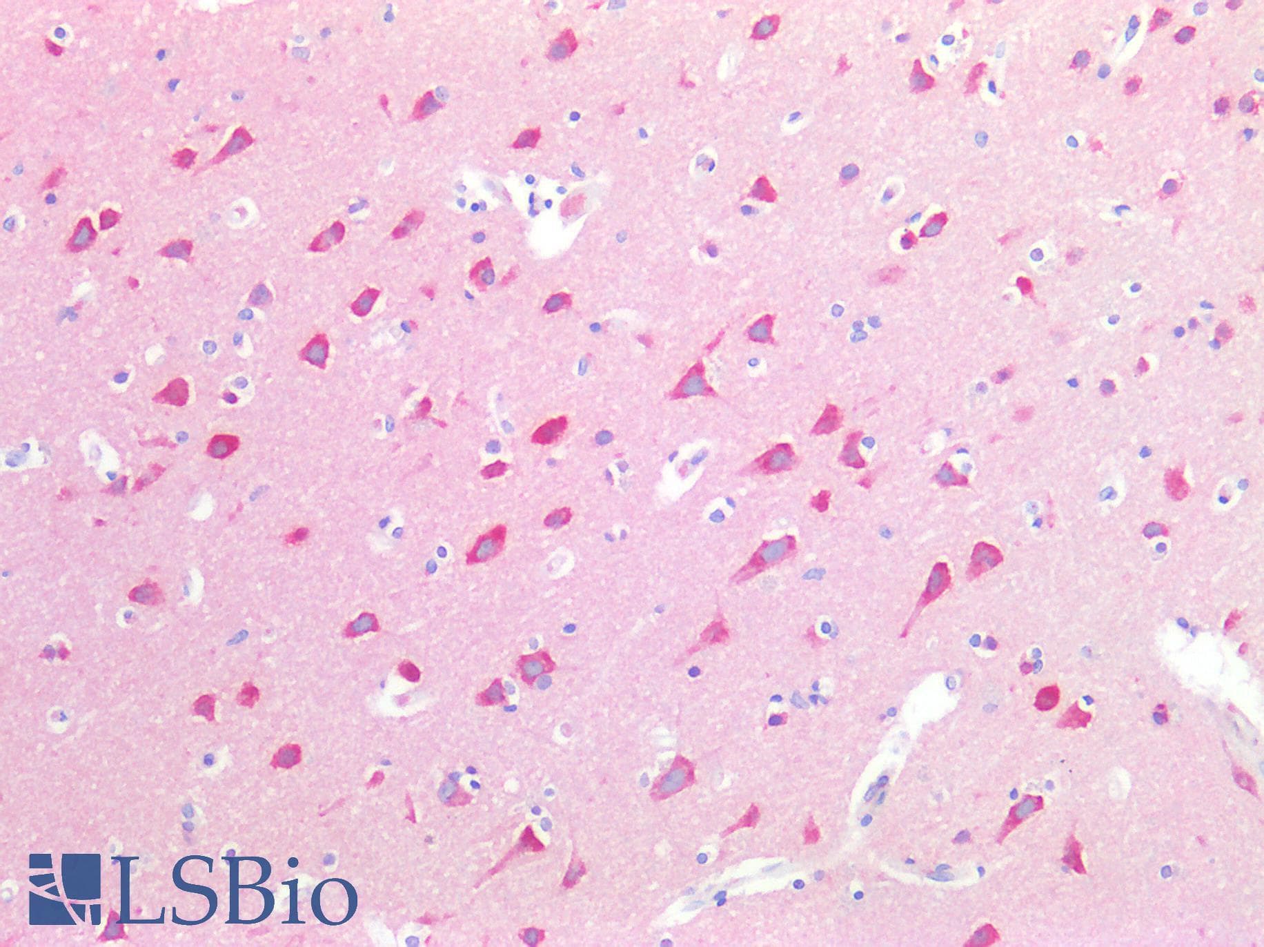 IHC-plus™ Syndapin I / PACSIN1 Antibody (aa8-38)