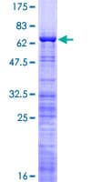 Human NIFK / MKI67IP Protein (Recombinant GST)