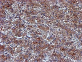 IDS / Iduronate 2 Sulfatase Antibody (clone OTI4G2)