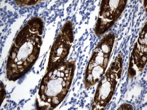 VIL1 / Villin Antibody (aa1-188, clone UMAB230)