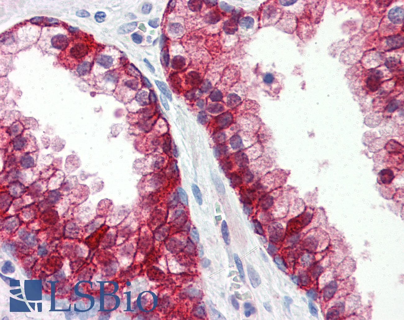 IHC-plus™ Monoclonal Mouse anti-Human ITGB1 / Integrin Beta 1 / CD29 Antibody (clone K2D5, aa34-141, IHC, WB)
