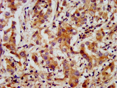 Polyclonal Rabbit anti-Human AMMECR1 Antibody (IHC, IF)