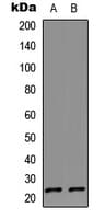 IL17D Antibody (C-Terminus)