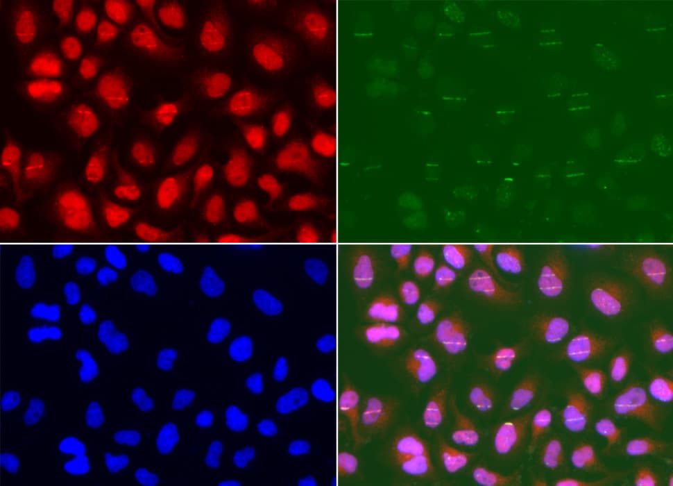 Polyclonal Rabbit anti-Human MSH2 Antibody (IHC, IF, WB)