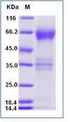 Human HAVCR2 / TIM-3 Protein (Recombinant Human IgG Fc, C-terminus)