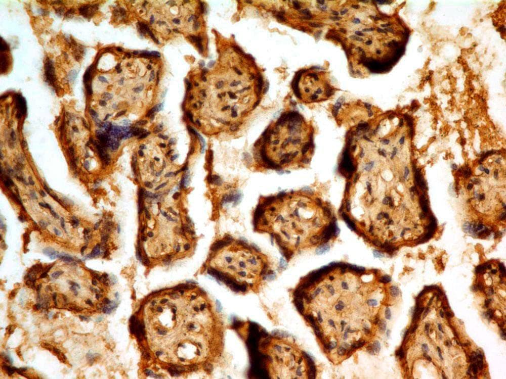 PAPPA / PAPP-A Antibody