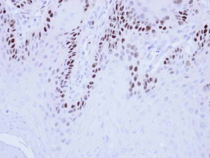 Polyclonal Rabbit anti-Human MCM3 Antibody (aa42-302, IHC, WB)