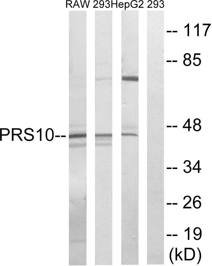 Polyclonal Rabbit anti-Human PSMC6 Antibody (WB)