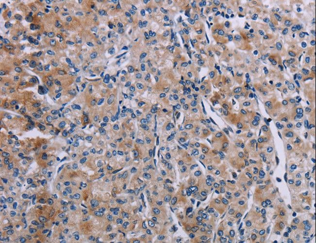 KDM4D / JMJD2D Antibody