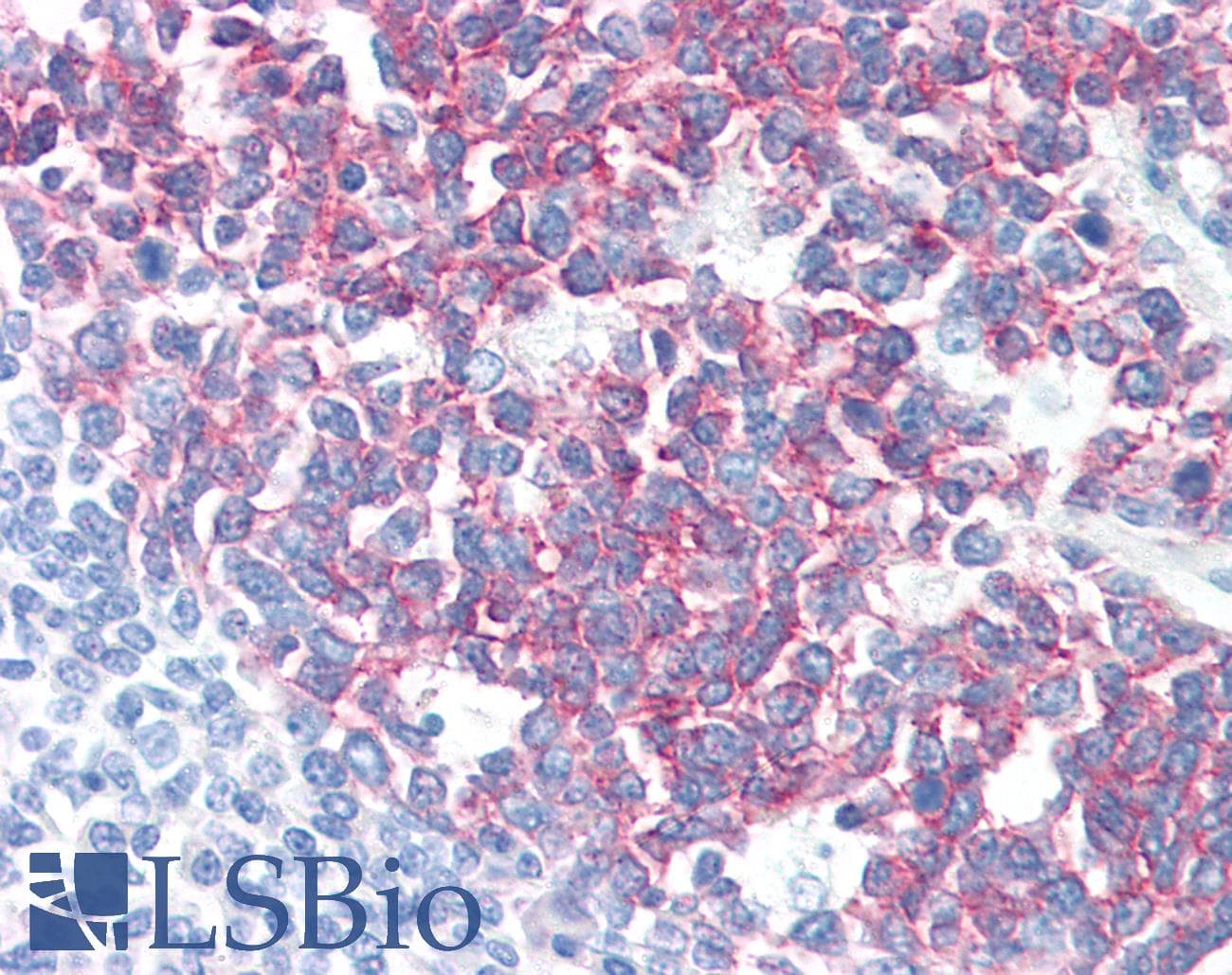 IHC-plus™ PAG1 Antibody (C-Terminus, clone PAG-C1)