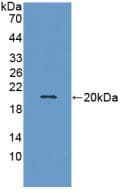 MMP9 / Gelatinase B Antibody (aa213-399, APC)