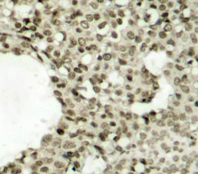 STAT1 Antibody (phospho-Ser727)