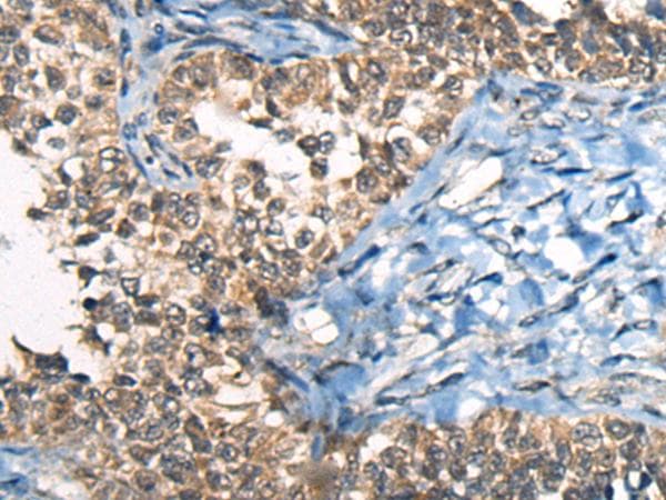 Polyclonal Rabbit anti-Human CDKL4 Antibody (IHC, WB)