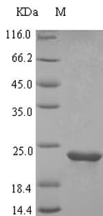Human PAEP / Glycodelin / GdF Protein (Recombinant 10His, N-terminus + Myc, C-terminus)