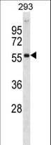 AKT2 Antibody (aa93-123)