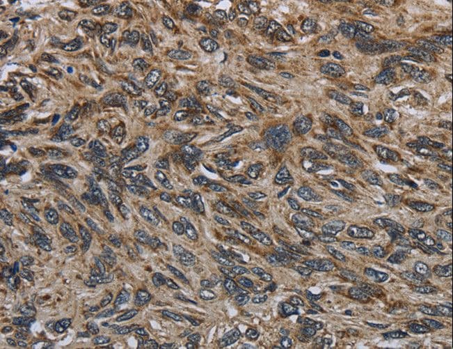 GYPC / Glycophorin C Antibody