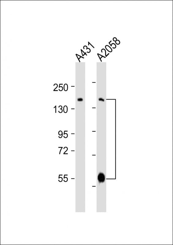 ADAMTS17 Antibody (aa508-540)