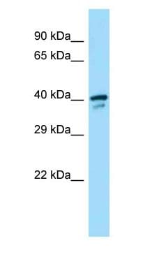 SMS / Spermine Synthase Antibody (aa150-199)