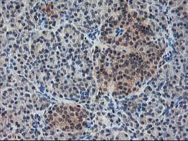 ALS2CR1 / NIF3L1 Antibody (clone OTI1F6)