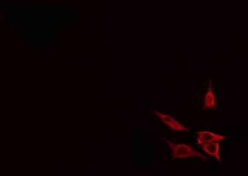 BLNK Antibody (phospho-Tyr96)