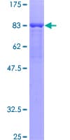 Human Yo / CDR2 Protein (Recombinant GST)