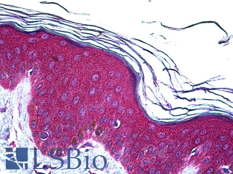 IHC-plus™ Monoclonal Mouse anti-Human UBE2D2 / UBCH5B Antibody (clone 4A1, IHC, WB)