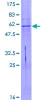 Human ART4 Protein (Recombinant GST)