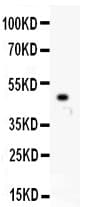 KIF2C / MCAK Antibody (aa531-725)
