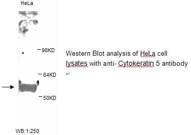 KRT5 / CK5 / Cytokeratin 5 Antibody