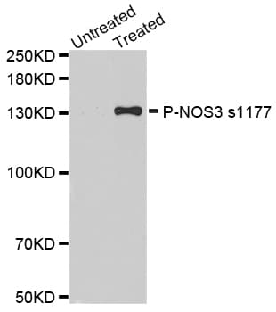 NOS3 / eNOS Antibody (phospho-Ser1177)