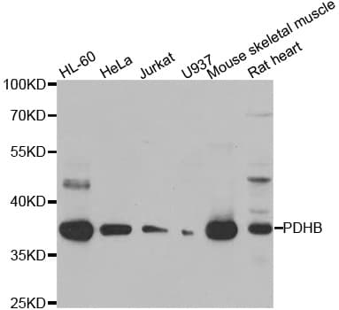 Polyclonal Rabbit anti-Human PDHB Antibody (IHC, WB)