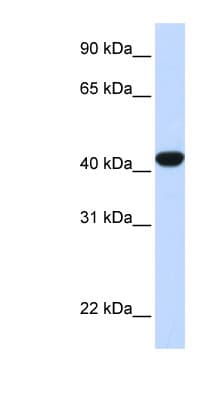 FAH Antibody (N-Terminus)