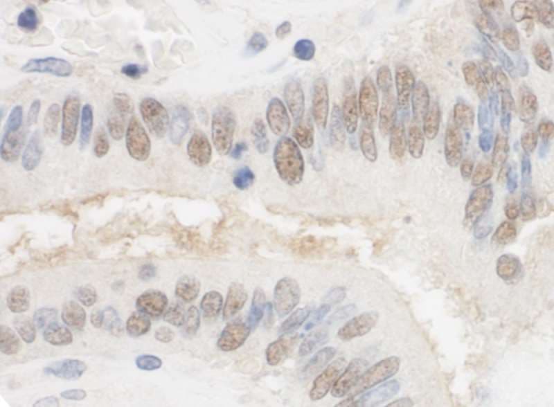 Polyclonal Rabbit anti-Human CSTF2T Antibody (aa566-616, IHC, WB)