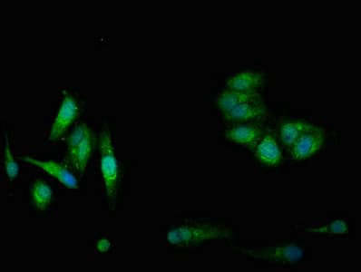 Polyclonal Rabbit anti-Human CBS Antibody (IHC, IF, WB)
