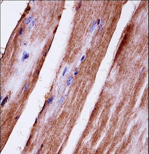 Polyclonal Rabbit anti-Mouse MAPK3 / ERK1 Antibody (aa353-380, IHC, WB)