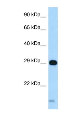 STX8 / Syntaxin 8 Antibody (aa162-211)