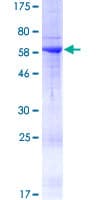 Human RAB36 Protein (Recombinant GST)