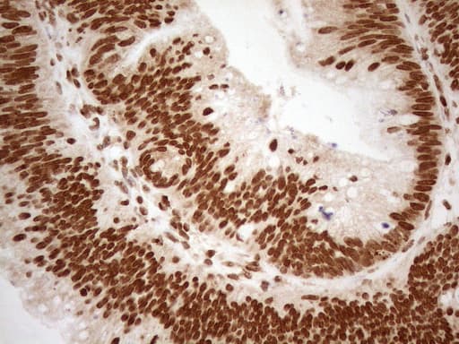 Monoclonal Mouse anti-Human ALOX5 / 5-LOX Antibody (clone OTI3F1, aa18-364, IHC, WB)