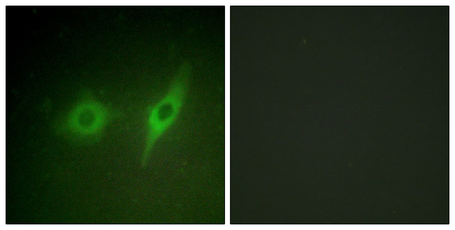 COL4A2 / Collagen IV Alpha2 Antibody (aa151-200)
