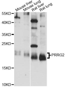 PRGP2 / PRRG2 Antibody