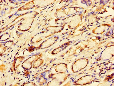 Polyclonal Rabbit anti-Human TFDP2 / DP2 Antibody (IHC, WB)