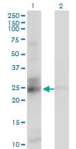GT335 / ES1 Antibody (clone 1F5)