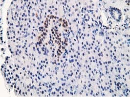 Monoclonal Mouse anti-Human STAT5A Antibody (clone 4.00E+07, Carrier-free, IHC, IF, WB)