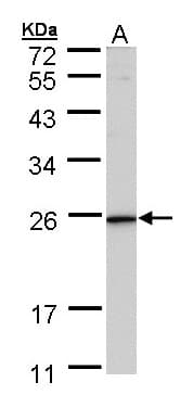 KLRG1 Antibody (aa1-195)