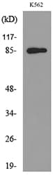 MPO / Myeloperoxidase Antibody