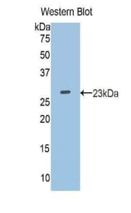 APOM / Apolipoprotein M Antibody (aa21-188)