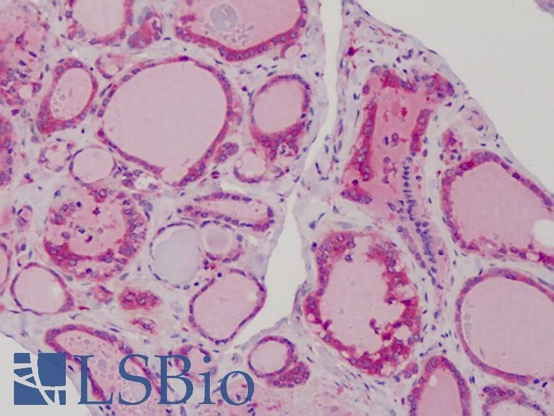 IHC-plus™ Polyclonal Rabbit anti-Human MAD2L1 / MAD2 Antibody (IHC, WB)