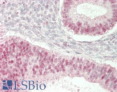 IHC-plus™ TLE1 / TLE 1 Antibody (aa175-225)
