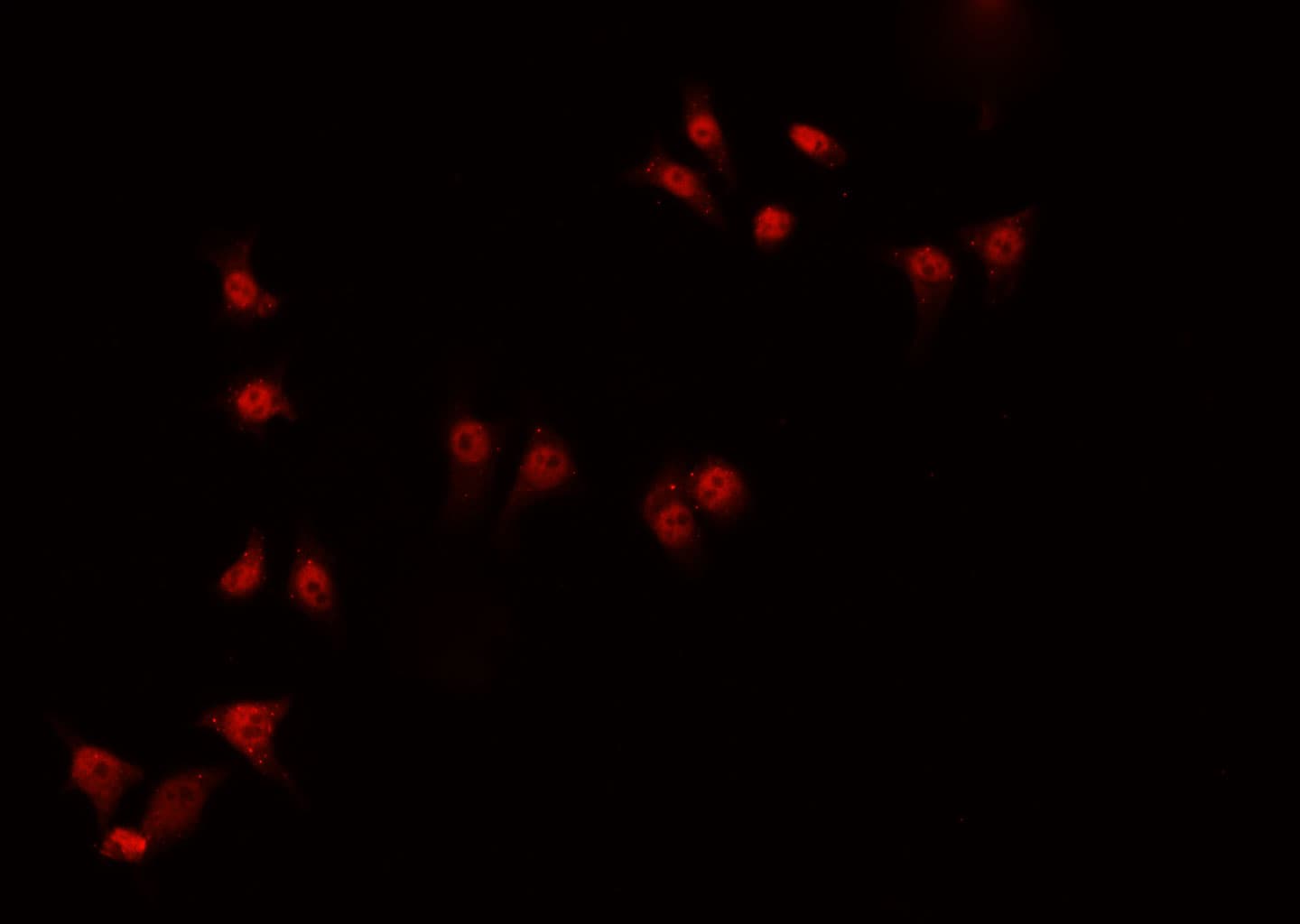ZNF174 Antibody